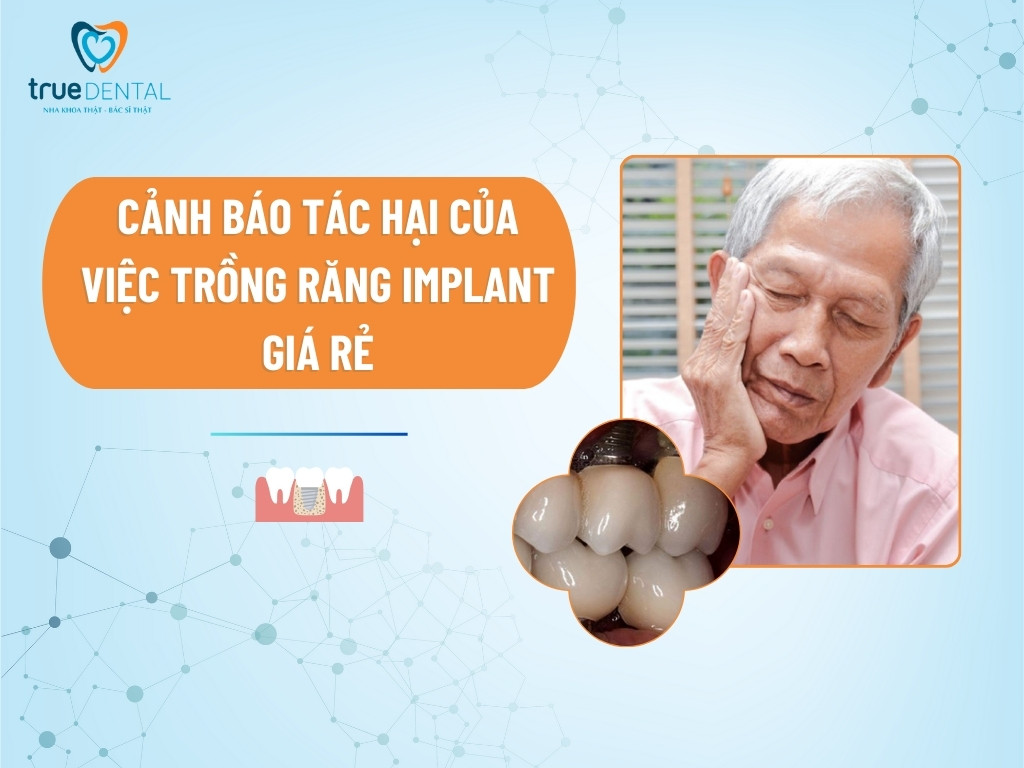 CẢNH BÁO TÁC HẠI CỦA VIỆC TRỒNG RĂNG IMPLANT GIÁ RẺ 6 CẢNH BÁO TÁC HẠI CỦA VIỆC TRỒNG RĂNG IMPLANT GIÁ RẺ