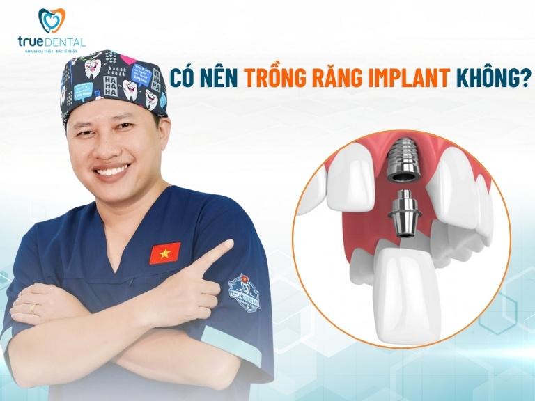 CẢNH BÁO TÁC HẠI CỦA VIỆC TRỒNG RĂNG IMPLANT GIÁ RẺ 1 Có nên trồng răng Implant không