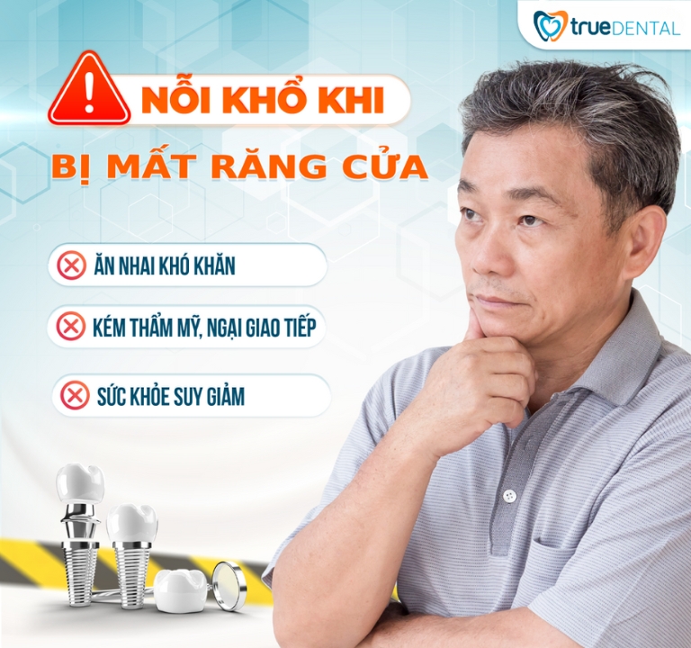 TRỒNG IMPLANT RĂNG CỬA: NHỮNG LƯU Ý CẦN BIẾT TRƯỚC KHI THỰC HIỆN 1 tác hại khi mất răng cửa
