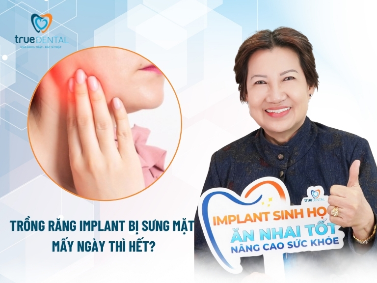 SAU KHI TRỒNG RĂNG IMPLANT BỊ SƯNG MẶT CÓ SAO KHÔNG? MẤY NGÀY THÌ HẾT? 3 trồng răng Implant bị sưng mặt mấy ngày thì hết