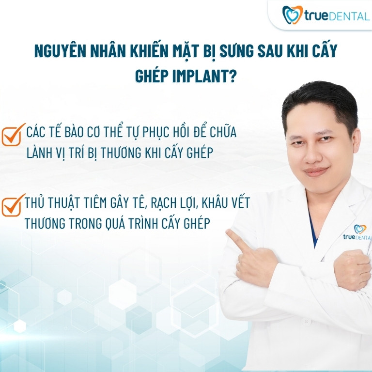 SAU KHI TRỒNG RĂNG IMPLANT BỊ SƯNG MẶT CÓ SAO KHÔNG? MẤY NGÀY THÌ HẾT? 2 nguyên nhân sau khi trồng răng implant bị sưng mặt