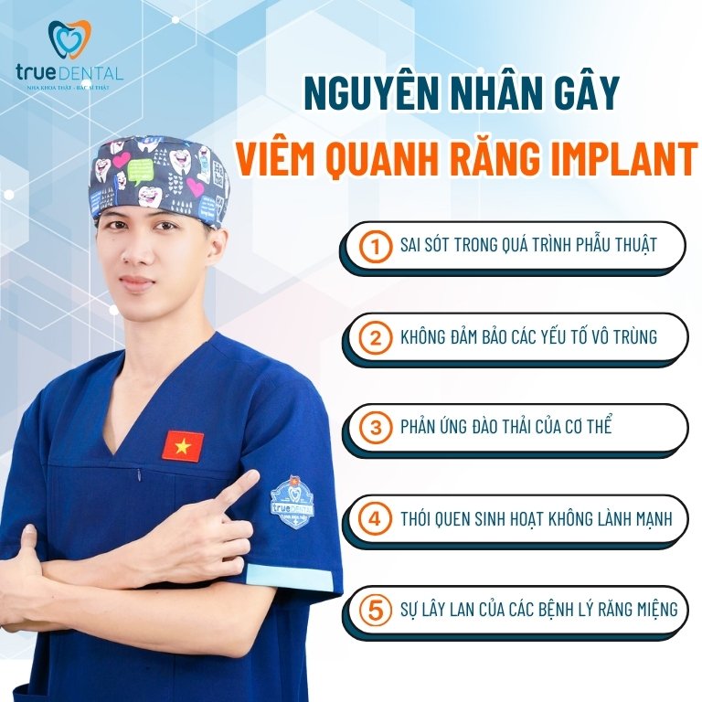 VIÊM QUANH RĂNG IMPLANT: NGUYÊN NHÂN, DẤU HIỆU VÀ CÁCH ĐIỀU TRỊ 2 nguyên nhân gây viêm quanh trụ Implant