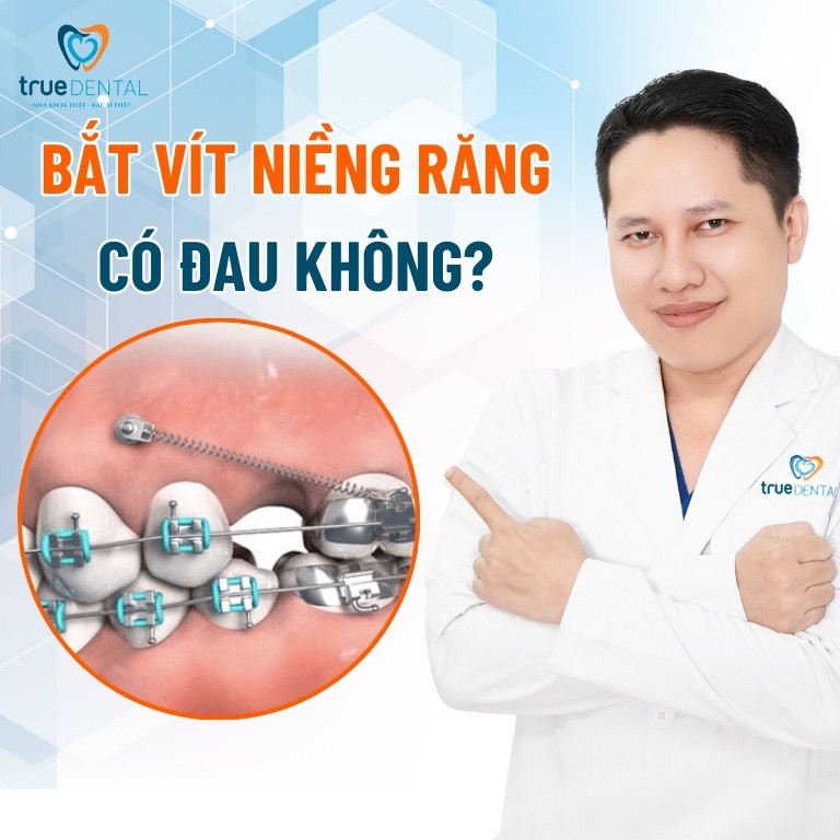 CẮM VÍT NIỀNG RĂNG LÀ GÌ? CÓ ĐAU KHÔNG VÀ KHI NÀO CẦN THỰC HIỆN 3 Bắt vít niềng răng có đau không?
