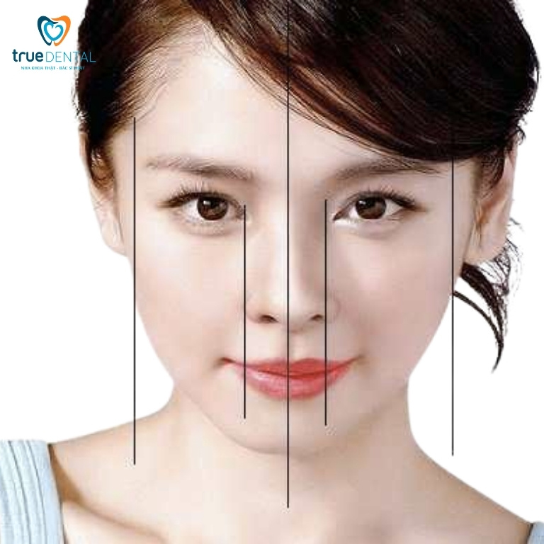 NGUYÊN NHÂN BỊ LỆCH MẶT KHI NIỀNG RĂNG VÀ CÁCH KHẮC PHỤC 1 Thế nào là bị lệch mặt?