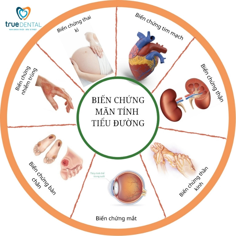 Bệnh tiểu đường là gì? Ảnh hưởng thế nào?