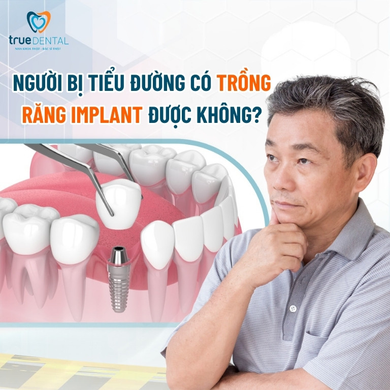 Người bị tiểu đường có trồng răng Implant được không?