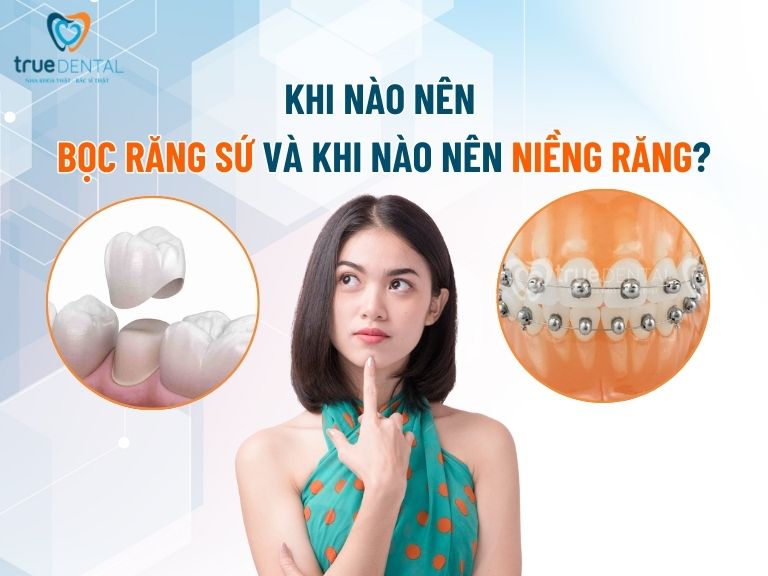 SAU KHI BỌC RĂNG SỨ CÓ NIỀNG ĐƯỢC KHÔNG? GIẢI ĐÁP TỪ BÁC SĨ TRUE DENTAL 4 Khi nào nên bọc sứ và khi nào nên niềng răng?