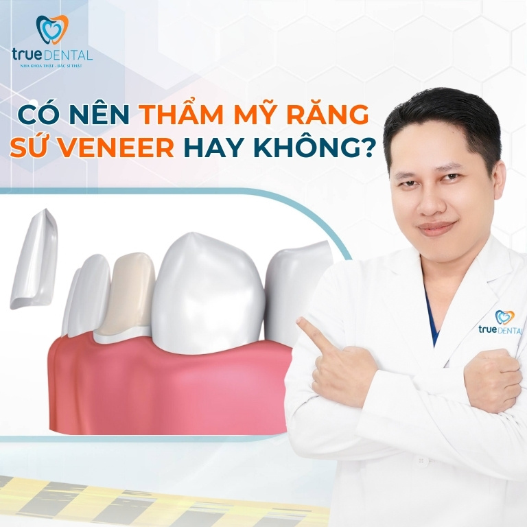 CÓ NÊN THẨM MỸ RĂNG SỨ VENEER HAY KHÔNG? NHỮNG TRƯỜNG HỢP NÊN VÀ KHÔNG NÊN 3 Có nên thẩm mỹ răng sứ Veneer hay không?