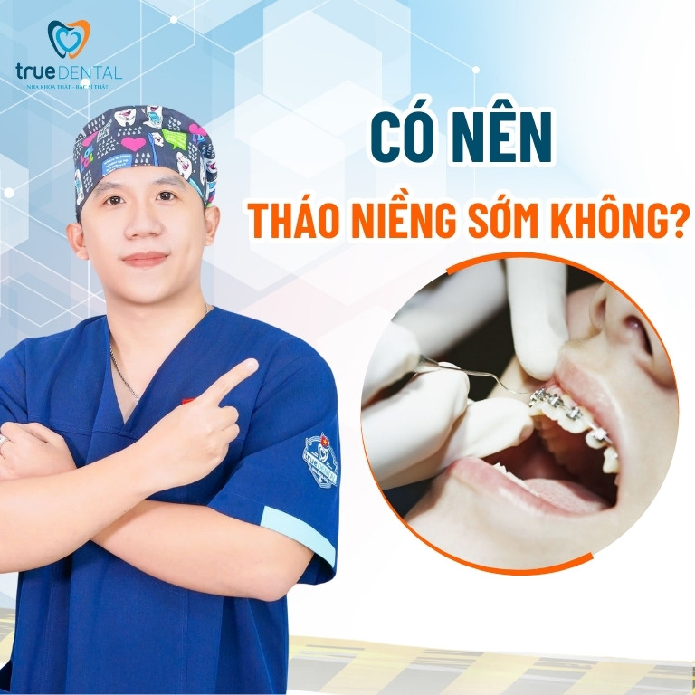 SAU KHI NIỀNG RĂNG BAO LÂU THÌ THÁO? CÓ NÊN THÁO NIỀNG SỚM KHÔNG? 3 Niềng răng bao lâu thì tháo sớm, rủi ro khi tháo niềng răng sớm