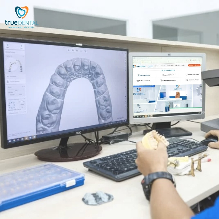 TÌM HIỂU VỀ CÔNG NGHỆ CAD/CAM TRONG PHỤC HÌNH RĂNG SỨ VENEER 1 Tổng quan về công nghệ CAD/CAM trong phục hình răng sứ Veneer
