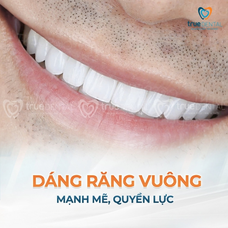DÁN SỨ VENEER CHO NAM GIỚI: XU HƯỚNG THẨM MỸ MỚI 5 Các dáng răng sứ Veneer đẹp cho nam giới