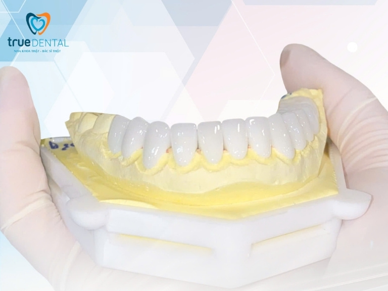 LÀM RĂNG SỨ THẨM MỸ LOẠI NÀO ĐẸP NHẤT HIỆN NAY? 1 Răng sứ là gì