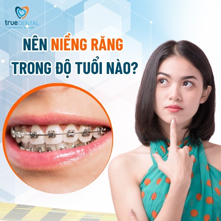 7 LỢI ÍCH KHI NIỀNG RĂNG SỚM CHO TRẺ BẠN NÊN BIẾT 1 Nên niềng răng trong độ tuổi nào?
