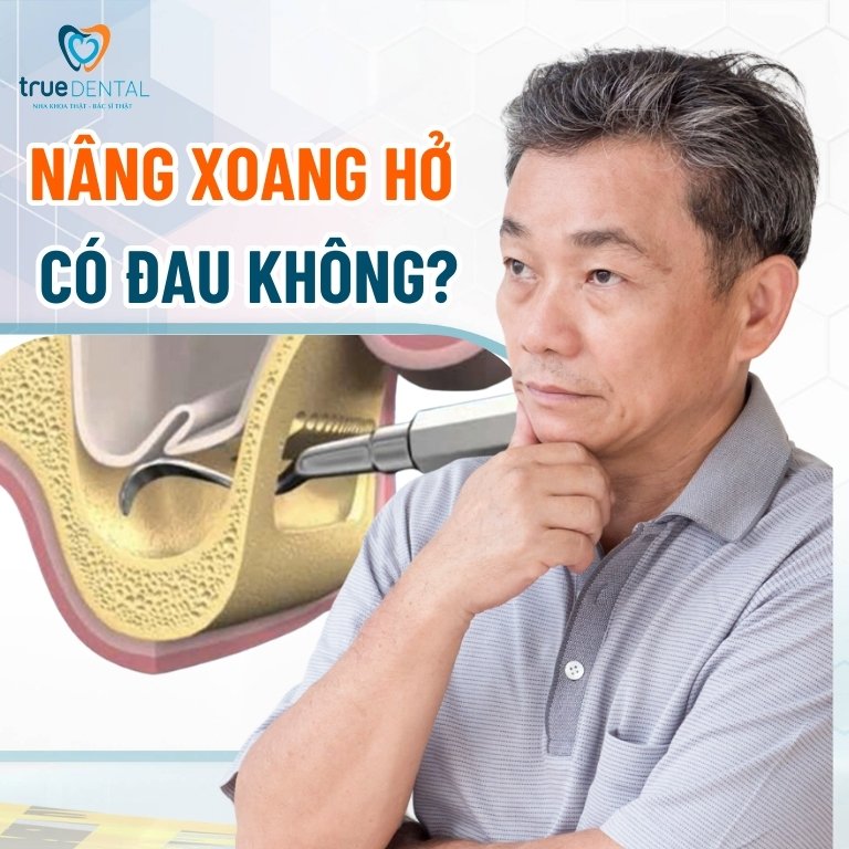 Nâng xoang hở trong cấy ghép Implant là gì? Có đau không? 3 Nâng xoang hở có đau không?