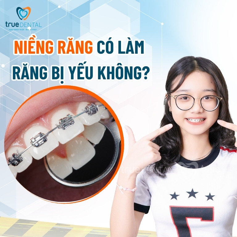 Niềng răng có làm răng bị yếu đi không?