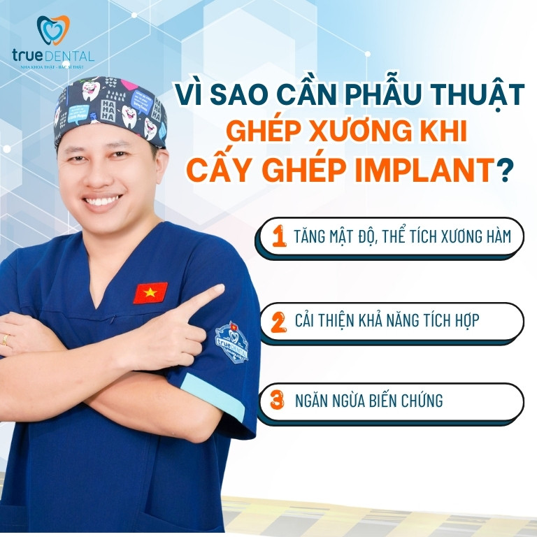 PHẪU THUẬT GHÉP XƯƠNG KHI CẤY GHÉP IMPLANT: QUY TRÌNH VÀ TRƯỜNG HỢP CẦN THỰC HIỆN 2 Vì sao cần phẫu thuật ghép xương khi cấy ghép Implant?