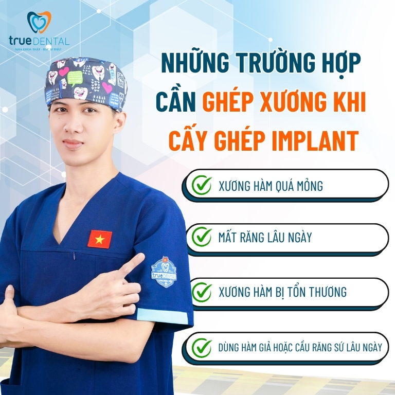 PHẪU THUẬT GHÉP XƯƠNG KHI CẤY GHÉP IMPLANT: QUY TRÌNH VÀ TRƯỜNG HỢP CẦN THỰC HIỆN 3 Những trường hợp nào cần ghép xương khi cấy ghép Implant
