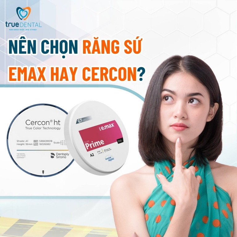 RĂNG SỨ EMAX VÀ CERCON: NÊN CHỌN LOẠI NÀO? 3 Nên chọn răng sứ Emax hay Cercon?