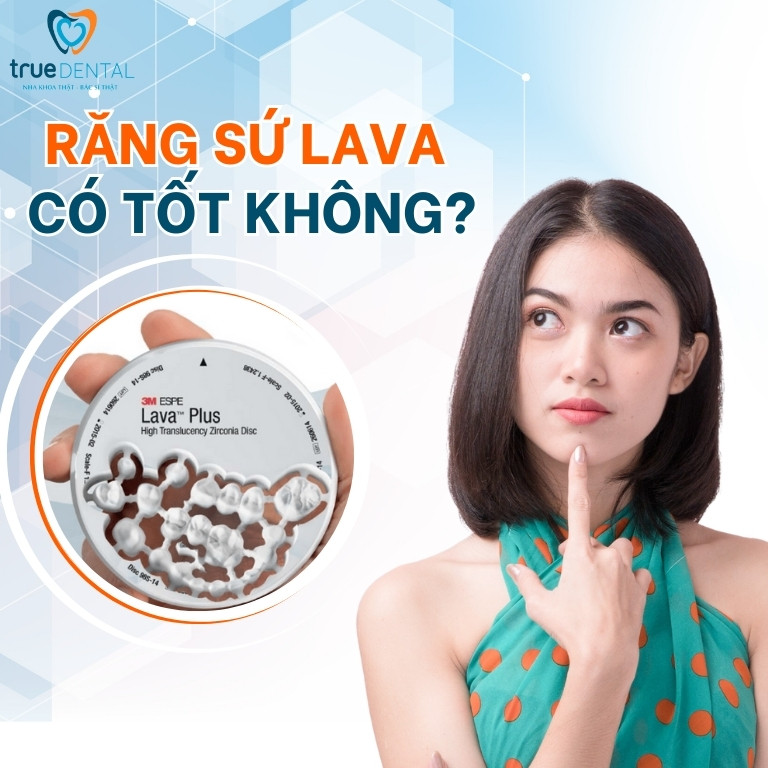 RĂNG SỨ LAVA CÓ TỐT KHÔNG? GIÁ RA SAO? NÊN DÙNG LOẠI NÀO? 2 Răng sứ Lava có tốt không?