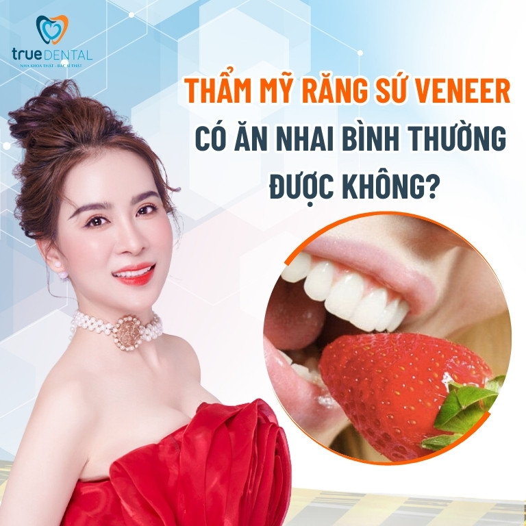 SAU KHI THẨM MỸ RĂNG SỨ VENEER CÓ ĂN NHAI BÌNH THƯỜNG ĐƯỢC KHÔNG? 2 Sau khi thẩm mỹ răng sứ Veneer có ăn nhai bình thường được không?