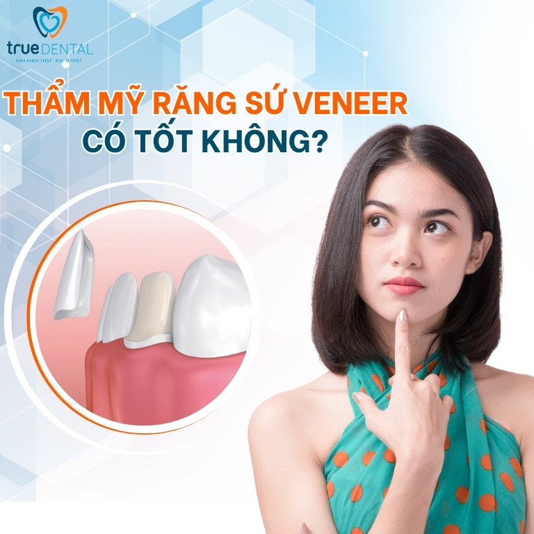 THẨM MỸ RĂNG SỨ VENEER CÓ TỐT KHÔNG? ƯU VÀ NHƯỢC ĐIỂM BẠN CẦN BIẾT 1 Thẩm mỹ răng sứ Veneer có tốt không?
