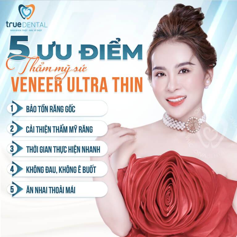 5 LỢI ÍCH KHI DÁN SỨ VENEER BẠN NÊN BIẾT 2 Lợi ích của phương pháp thẩm mỹ răng sứ Veneer