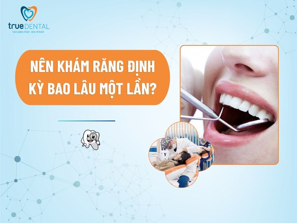 [Giải đáp] Nên khám răng định kỳ bao lâu một lần? - True Dental - Nha ...