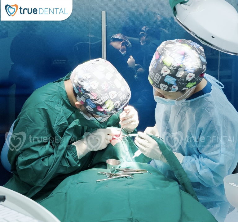 LẤY DẤU IMPLANT LÀ GÌ? QUY TRÌNH VÀ PHƯƠNG PHÁP THỰC HIỆN 5 Quy trình lấy dấu Implant tại True Dental