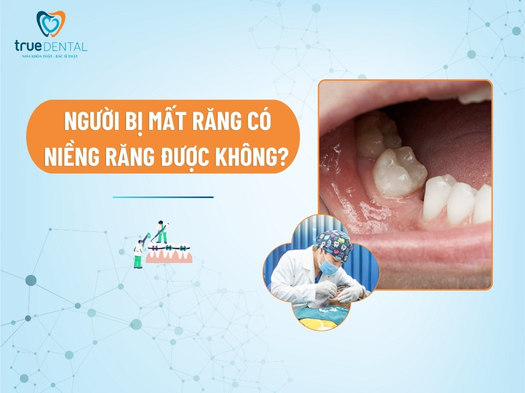 [Giải đáp] Người bị mất răng có niềng răng được không? - True Dental ...