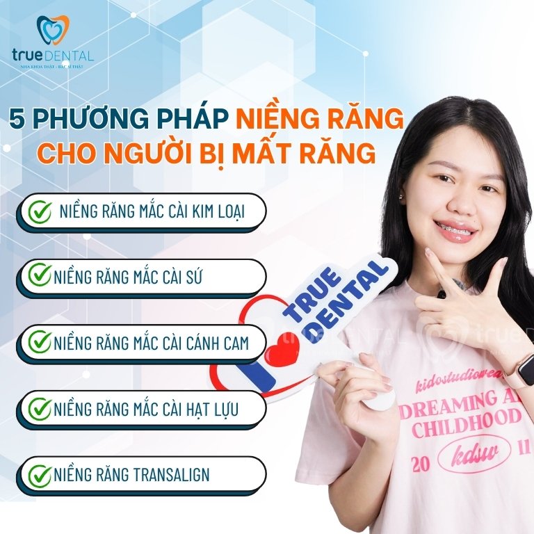 Các phương pháp niềng răng phù hợp cho người bị mất răng