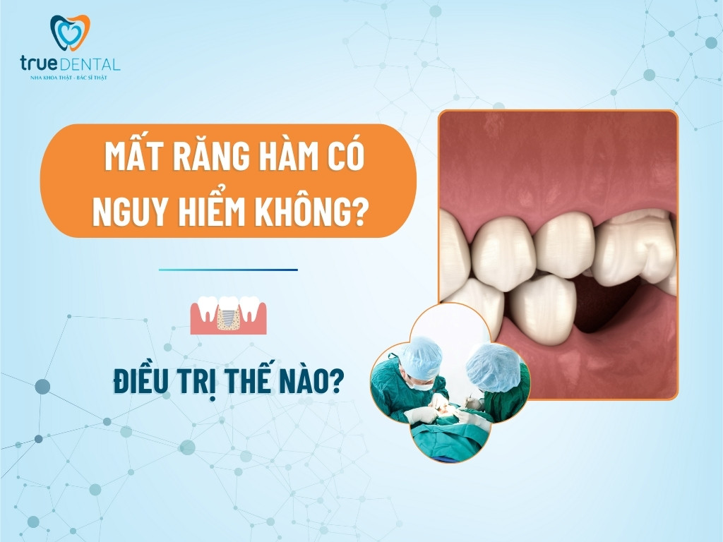 [Giải đáp] Mất răng hàm có nguy hiểm không? Điều trị thế nào? - True ...