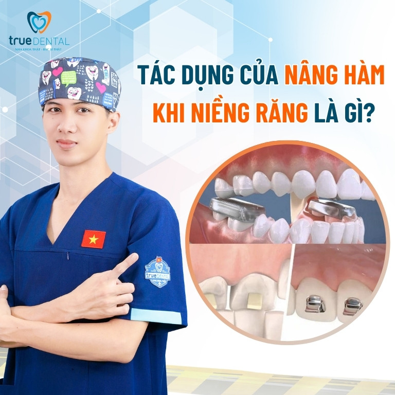 NÂNG HÀM KHI NIỀNG RĂNG CÓ TÁC DỤNG GÌ? CÓ ĐAU KHÔNG? 2 Tác dụng của nâng hàm khi niềng răng là gì?