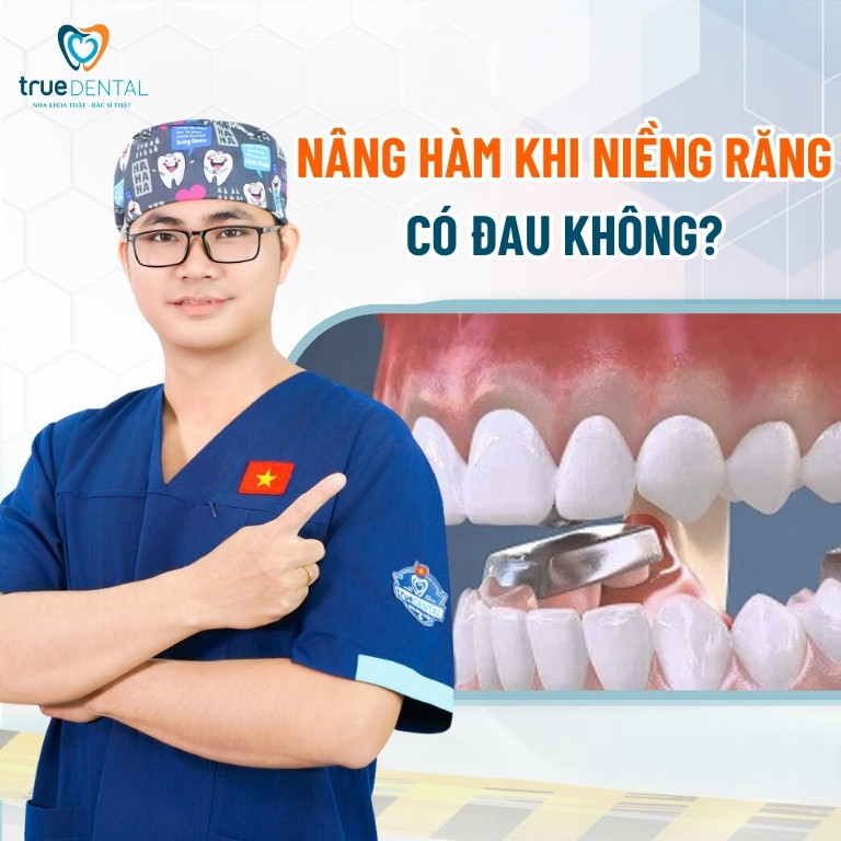 NÂNG HÀM KHI NIỀNG RĂNG CÓ TÁC DỤNG GÌ? CÓ ĐAU KHÔNG? 4 Nâng hàm khi niềng răng có đau không?