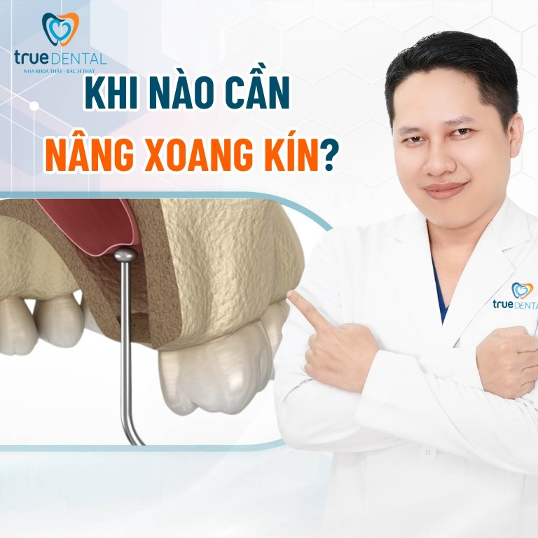 NÂNG XOANG KÍN LÀ GÌ? KHI NÀO CẦN THỰC HIỆN? 2 Khi nào cần nâng xoang kín?