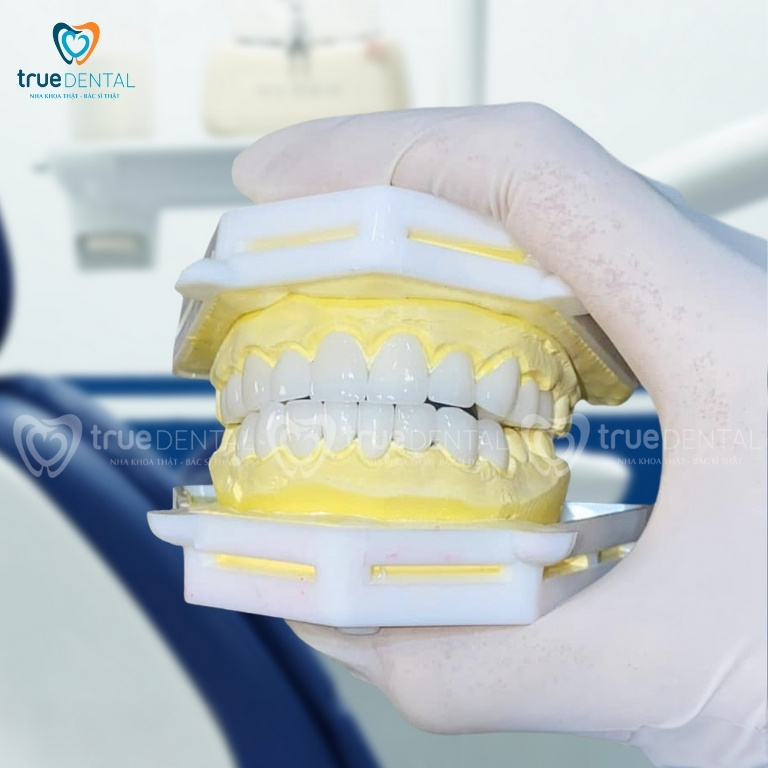 HƯỚNG DẪN CÁCH NHẬN BIẾT RĂNG SỨ CHÍNH HÃNG TỪ BÁC SĨ TRUE DENTAL 1 Răng sứ chính hãng với bề mặt sáng bóng tự nhiên