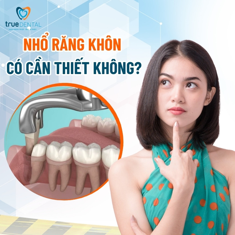NHỔ RĂNG KHÔN CÓ CẦN THIẾT KHÔNG? KHI NÀO NÊN LOẠI BỎ RĂNG SỐ 8 2 nhổ răng khôn có cần thiết không