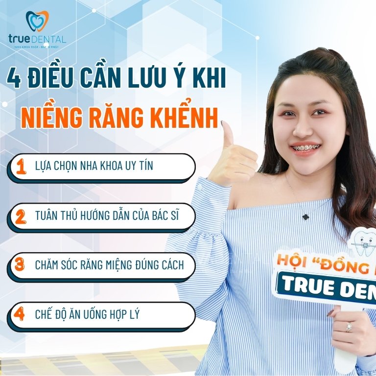 Có nên niềng răng khểnh không? Giá bao nhiêu 7 4 điều cần lưu ý khi niềng răng khểnh