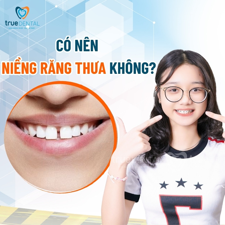 CÓ NÊN NIỀNG RĂNG THƯA KHÔNG? PHƯƠNG PHÁP, THỜI GIAN VÀ CHI PHÍ NIỀNG 2 Có nên niềng răng thưa không?