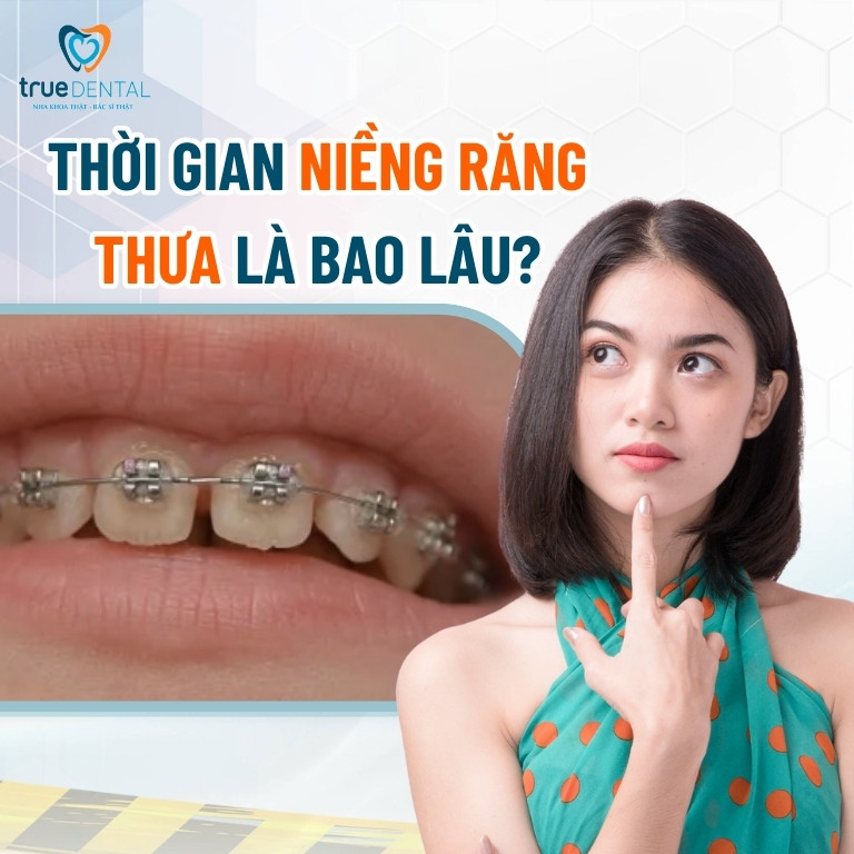 CÓ NÊN NIỀNG RĂNG THƯA KHÔNG? PHƯƠNG PHÁP, THỜI GIAN VÀ CHI PHÍ NIỀNG 4 Thời gian niềng răng thưa là bao lâu?