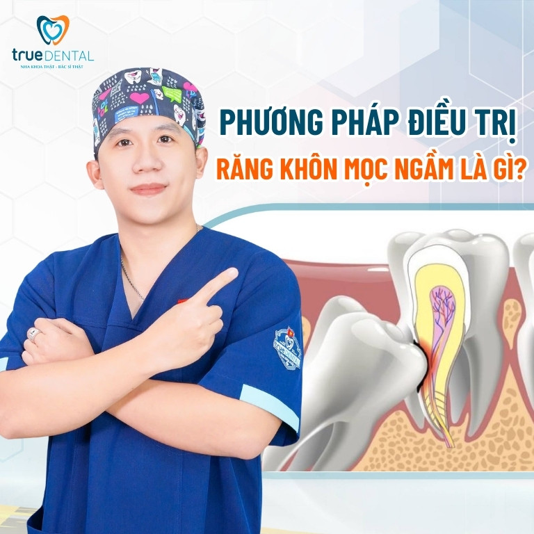 RĂNG KHÔN MỌC NGẦM: NGUYÊN NHÂN, DẤU HIỆU NHẬN BIẾT VÀ CÁCH CHỮA TRỊ 5 phương pháp điều trị răng số 8 mọc ngầm là gì