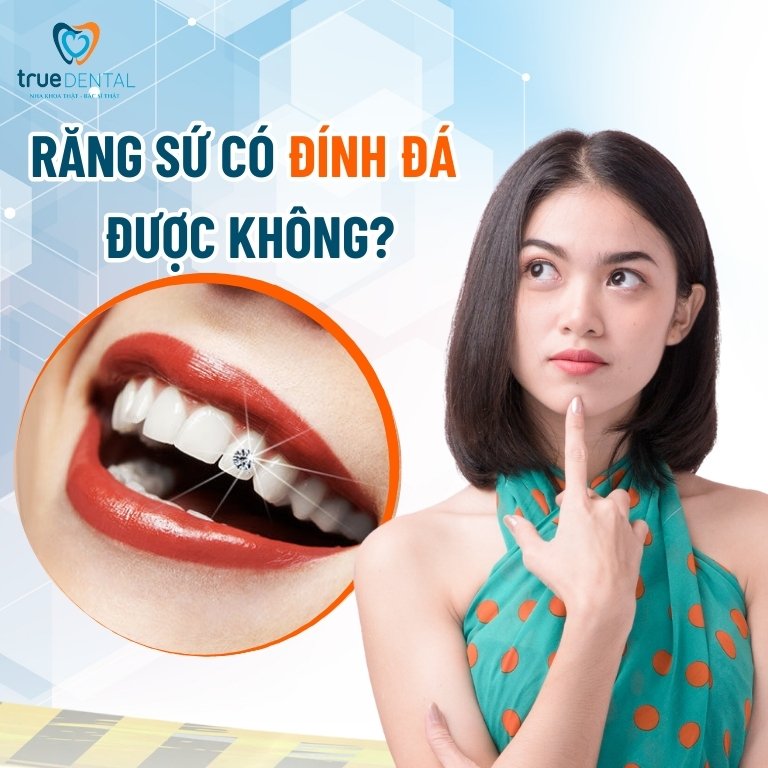 Răng sứ có đính đá được không?
