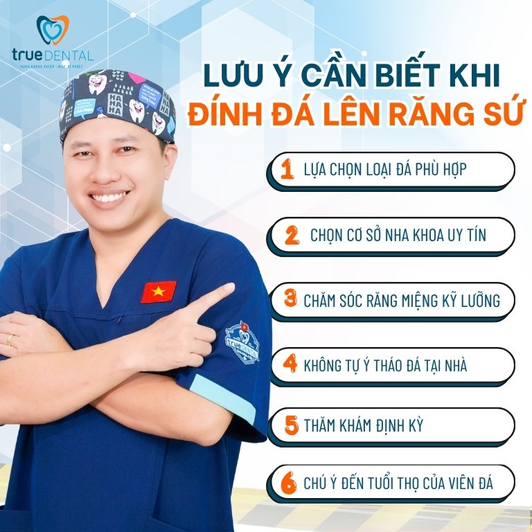Lưu ý cần biết khi đính đá lên răng sứ