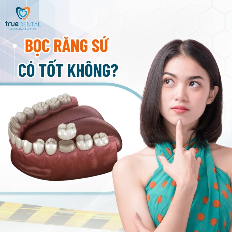 Bọc răng sứ là gì? Giá bọc răng sứ, quy trình thực hiện 3 Bọc răng sứ có tốt không?