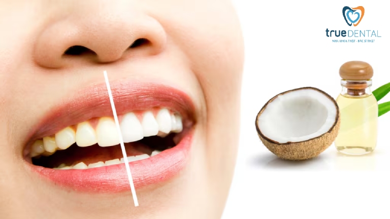 Cách làm trắng răng tại nhà hiệu quả, đơn giản nhanh nhất 7 Tẩy trắng răng với dầu dừa tại nhà