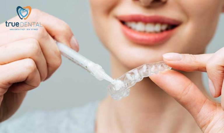 Cách làm trắng răng tại nhà hiệu quả, đơn giản nhanh nhất 8 Sử dụng máng tẩy trắng răng tại nhà