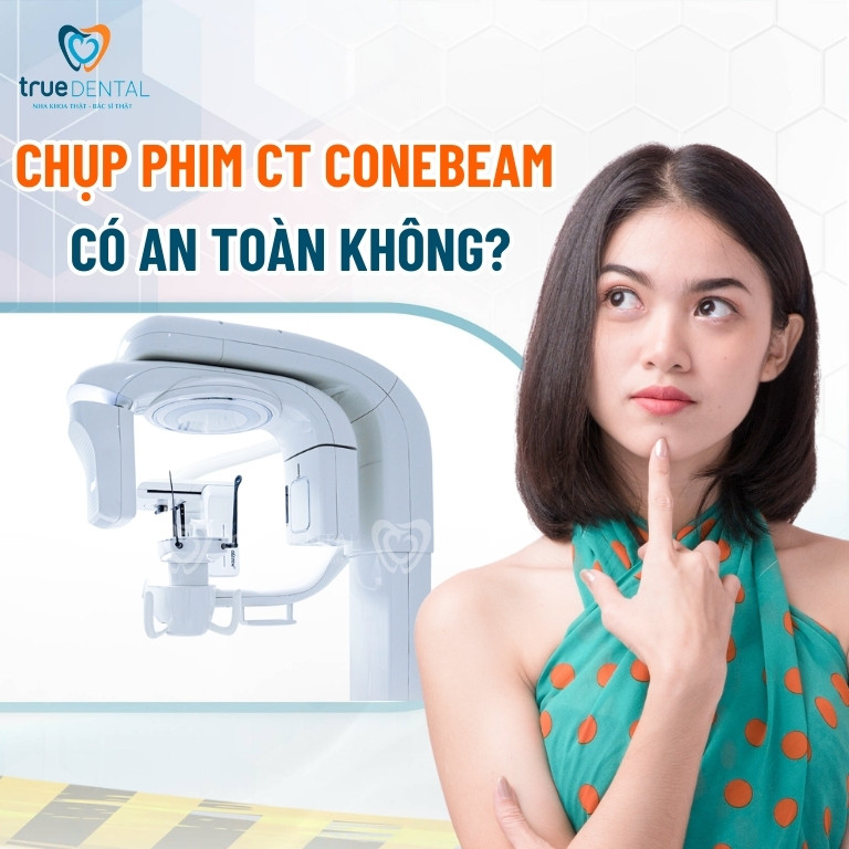 CHỤP PHIM CT CONEBEAM LÀ GÌ? KHI NÀO CẦN THỰC HIỆN 4 Chụp phim CT ConeBeam có an toàn không?