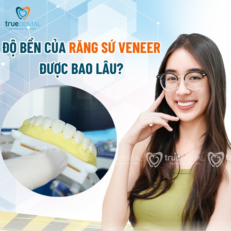 ĐỘ BỀN CỦA RĂNG SỨ VENEER ĐƯỢC BAO LÂU? NHỮNG YẾU TỐ ẢNH HƯỞNG TUỔI THỌ RĂNG SỨ 3 Độ bền của răng sứ Veneer được bao lâu?