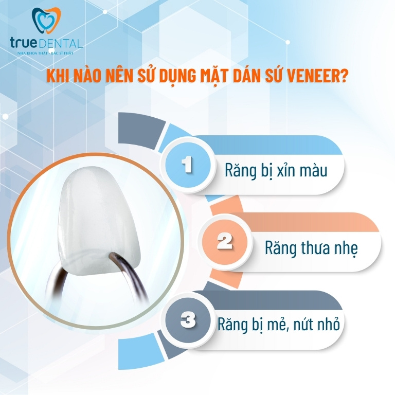 MẶT DÁN SỨ VENEER VÀ NHỮNG ĐIỀU BẠN CẦN BIẾT 3 Khi nào nên sử dụng mặt dán sứ Veneer?