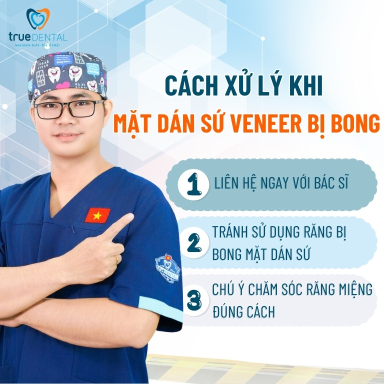 MẶT DÁN SỨ VENEER CÓ BỊ BONG RA KHÔNG? CÁCH XỬ LÝ LÀ GÌ? 3 Cách xử lý khi mặt dán sứ Veneer bị bong