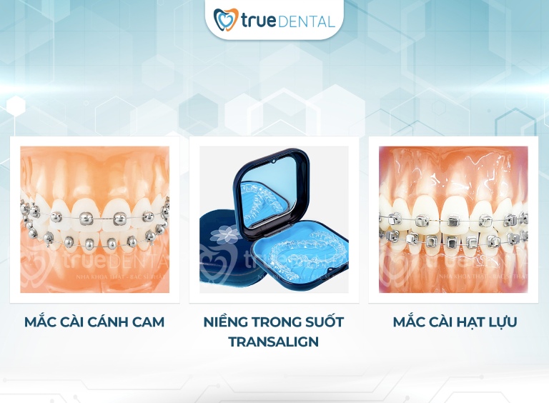 10 NHA KHOA QUẬN 1 UY TÍN, CHẤT LƯỢNG BÁC SĨ GIỎI 4 Dịch vụ nổi bật tại True Dental